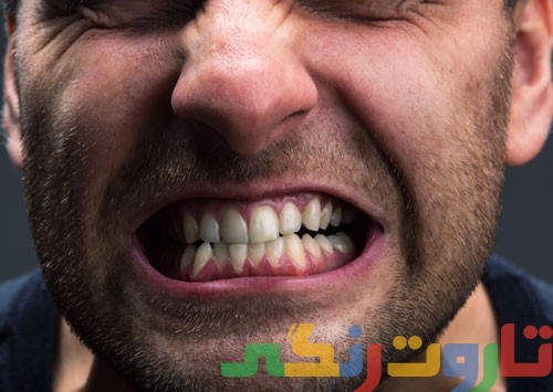 دندان درد و عصبانیت