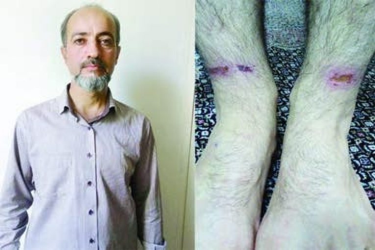فرار گروگان 800 میلیونی از دست مرد افغانی