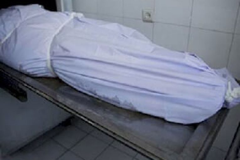عمل ساکشن چربی جان زن تهرانی را گرفت