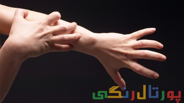 خشکی پوست و خارش آن در زمستان خشکی پوست و خارش آن در زمستان