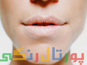 درمان خشکی لب در هوای سرد درمان خشکی لب در هوای سرد