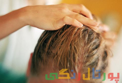 تکنیکی مناسب برای مبارزه با موهای چرب