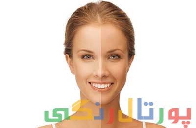  برنزه کردن