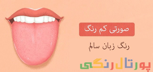 رنگ زبان شما نشانگر سلامتی شماست