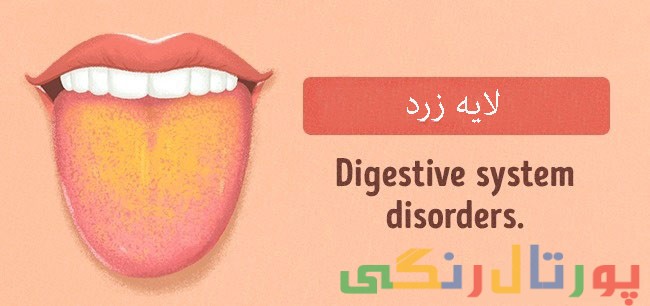 رنگ زبان شما نشانگر سلامتی شماست