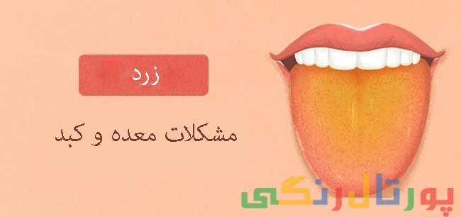 رنگ زبان شما نشانگر سلامتی شماست