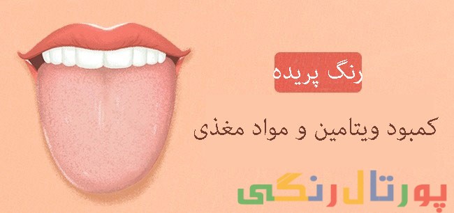 رنگ زبان شما نشانگر سلامتی شماست