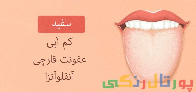 رنگ زبان شما نشانگر سلامتی شماست