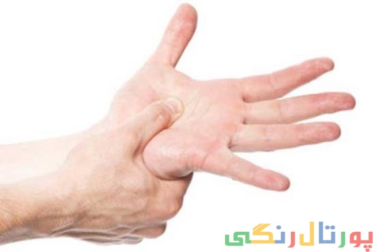 روشهای درمان عرق کردن کف دست و پا
