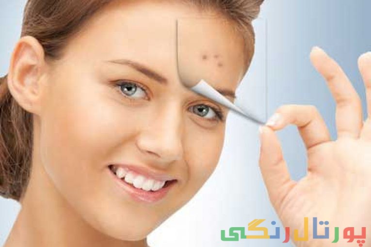 لباس های موثر در بروز جوش و آکنه را بشناسید