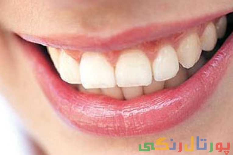 لیست روشهای خانگی برای درمان دندان درد