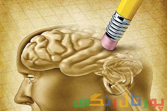 زوال عقل در چه سنی در زنان اتفاق می افتد؟