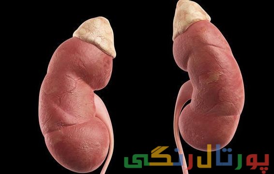 مصرف نمک و بیماری کلیوی