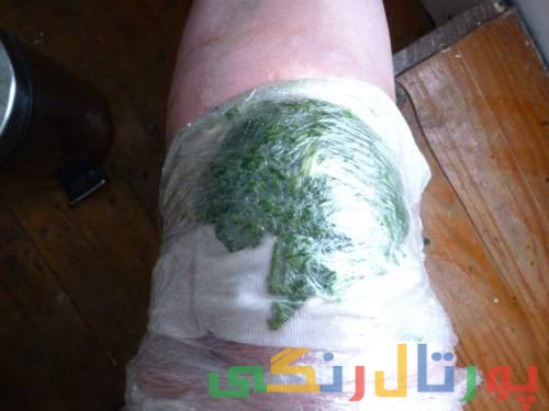 درمان درد مفاصل با کلم برگ + خواص انواع کلم