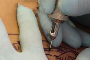 دانستنی های پزشکی درباره عوارض و خطرات تاتو