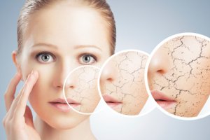 اشتباهاتی که علت خشکی پوست در زمستان هستند!